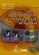 Passo a Passo da Cirurgia Lasik