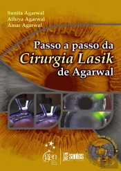Passo a Passo da Cirurgia Lasik