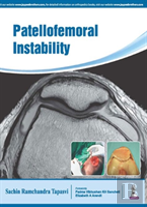 Patellofemoral Instability