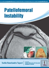 Patellofemoral Instability