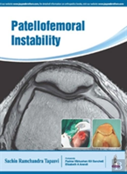 Bertrand.pt - Patellofemoral Instability