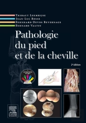Pathologie Du Pied Et De La Cheville (2e Édition)