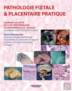 Bertrand.pt - Pathologie F½Tale Et Placentaire Pratique