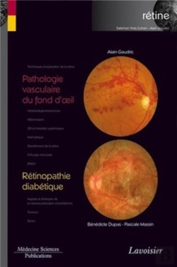 Bertrand.pt - Pathologie Vasculaire Du Fond D'Oeil ; Rétinopathie Diabétique