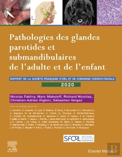 Bertrand.pt - Pathologies Des Glandes Parotides Et Submandibulaires De L'Adulte Et De L'Enfant