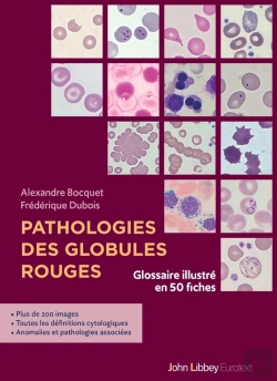 Bertrand.pt - Pathologies Des Globules Rouges : Glossaire Illustré En 50 Fiches