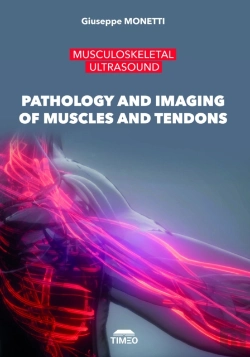 Bertrand.pt - Pathology And Imaging Of Muscles And Tendons