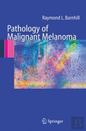Pathology Of Malignant Melanoma