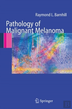 Bertrand.pt - Pathology Of Malignant Melanoma