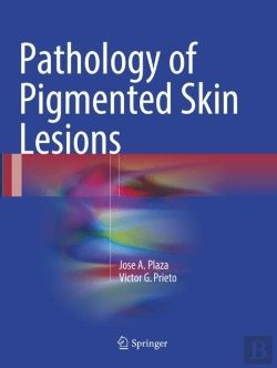 Bertrand.pt - Pathology Of Pigmented Skin Lesions