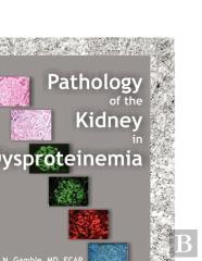 Pathology Of The Kidney In Dysproteinemia