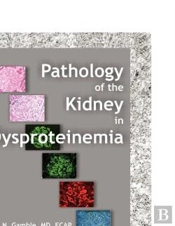 Bertrand.pt - Pathology Of The Kidney In Dysproteinemia