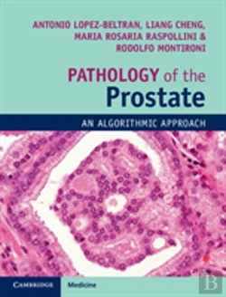 Bertrand.pt - Pathology Of The Prostate