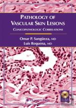 Pathology Of Vascular Skin Lesions