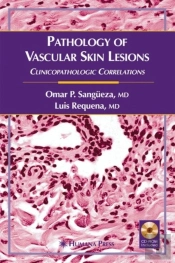 Pathology Of Vascular Skin Lesions
