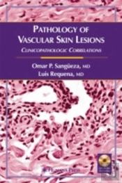 Pathology Of Vascular Skin Lesions