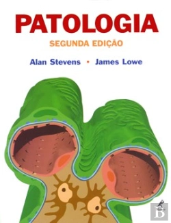 Bertrand.pt - Patologia