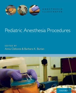 Bertrand.pt - Pediatric Anesthesia Procedures