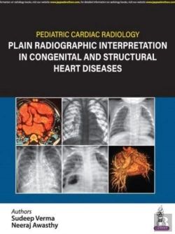Bertrand.pt - Pediatric Cardiac Radiology