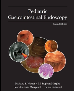 Bertrand.pt - Pediatric Gastrointestinal Endoscopy