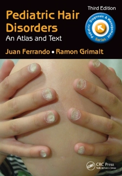 Bertrand.pt - Pediatric Hair Disorders