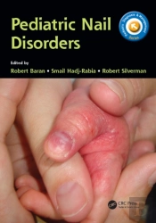 Pediatric Nail Disorders