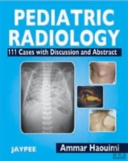 Bertrand.pt - Pediatric Radiology
