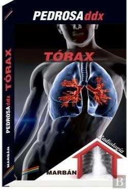 Bertrand.pt - Pedrosa Ddx Torax