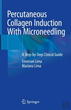 Bertrand.pt - Percutaneous Collagen Induction With Microneedling