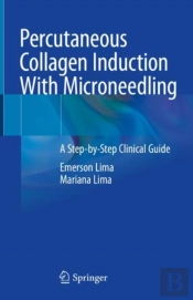 Percutaneous Collagen Induction With Microneedling