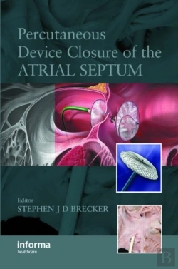 Bertrand.pt - Percutaneous Device Closure Of The Atrial Septum