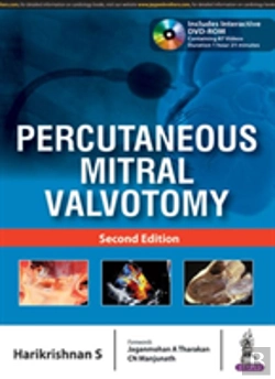 Bertrand.pt - Percutaneous Mitral Valvotomy