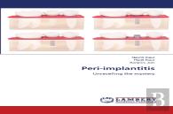 Peri-Implantitis