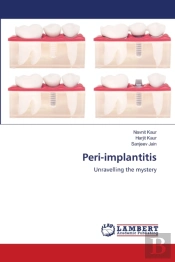 Peri-Implantitis