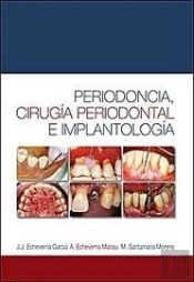 Periodoncia, Cirug¡A Periodontal E Implantolog¡A