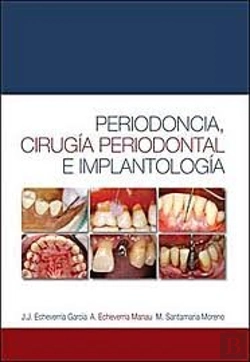 Bertrand.pt - Periodoncia, Cirug¡A Periodontal E Implantolog¡A
