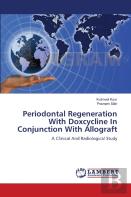 Periodontal Regeneration With Doxcycline In Conjunction With Allograft