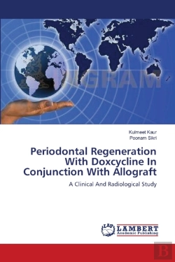 Bertrand.pt - Periodontal Regeneration With Doxcycline In Conjunction With Allograft