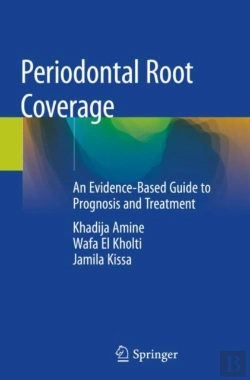 Bertrand.pt - Periodontal Root Coverage