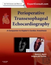 Perioperative Transesophageal Echocardiography