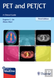 Pet And Pet/Ct
