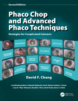 Bertrand.pt - Phaco Chop And Advanced Phaco Techniques