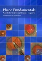 Phaco Fundamentals