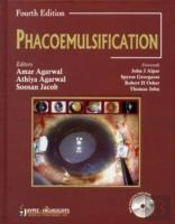 Phacoemulsification, Fourth Edition