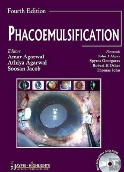 Bertrand.pt - Phacoemulsification Surgery