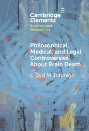Philosophical, Medical, And Legal Controversies About Brain Death