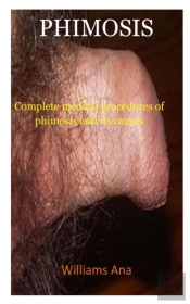 Phimosis