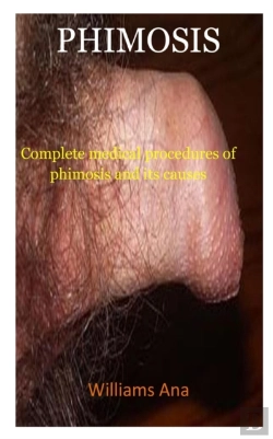 Bertrand.pt - Phimosis