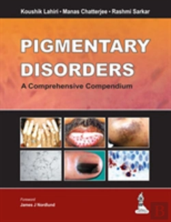 Bertrand.pt - Pigmentary Disorders