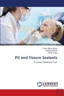 Bertrand.pt - Pit And Fissure Sealants